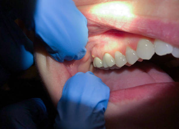 Best Emergency Treatment for Toothache in Candler Mcafee, GA