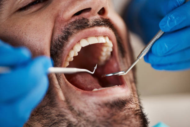 Best Emergency Broken Tooth Repair in Candler Mcafee, GA