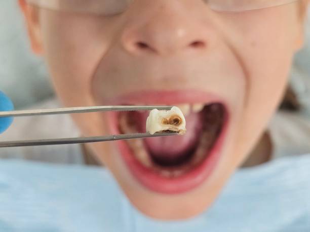 Best 24-Hour Emergency Dentist in Candler Mcafee, GA