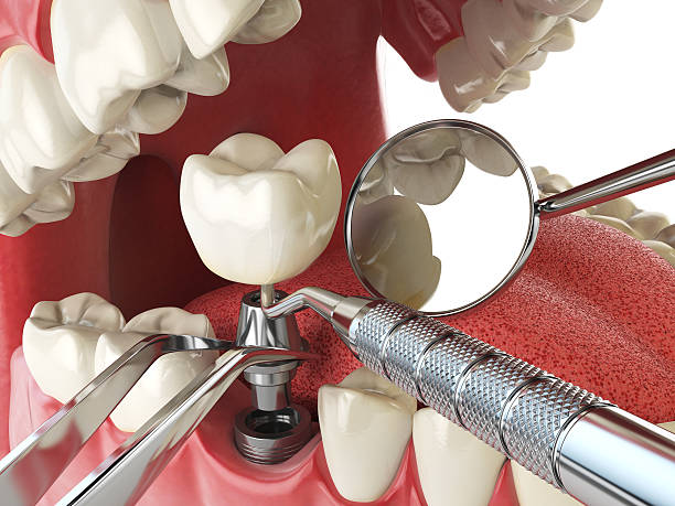 Best Emergency Dental Surgery in Candler Mcafee, GA